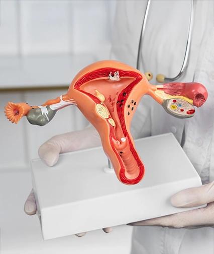 Intrauterine Insemination Procedure